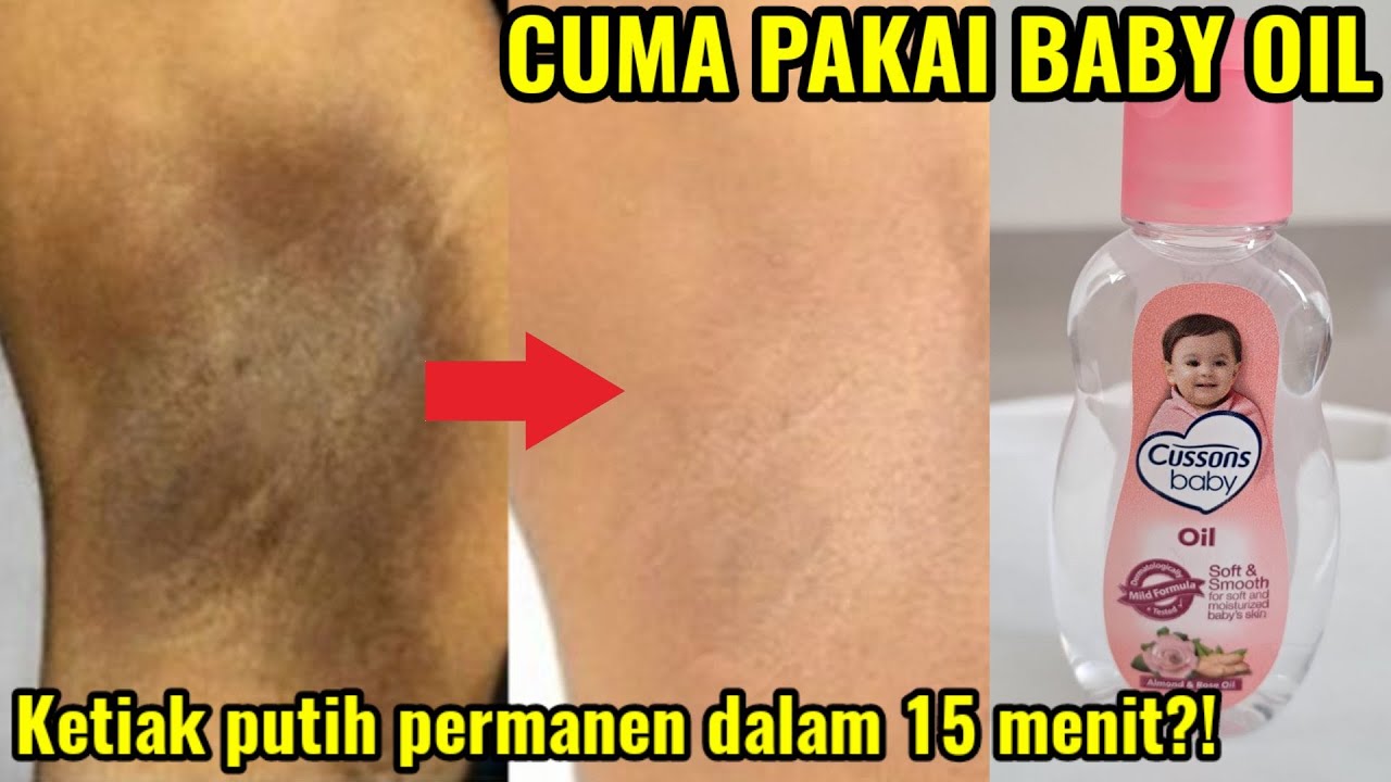 3 Cara Memutihkan Ketiak dengan Baby Oil, Bikin Kulit Mulus dan Putih Bebas Bau dan Keringat