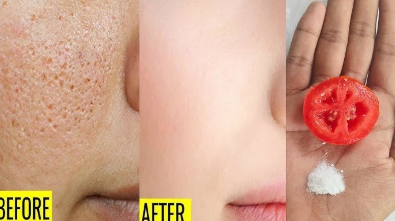 DIY Masker Tomat untuk Mengelupas Flek Hitam, Glowing Pakai 2 Bahan Ini