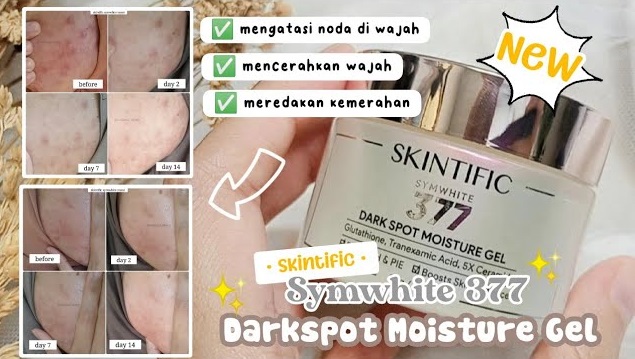 Review Moisturizer Skintific untuk Menghilangkan Dark Spot Symwhite 377, Benarkah Ampuh?