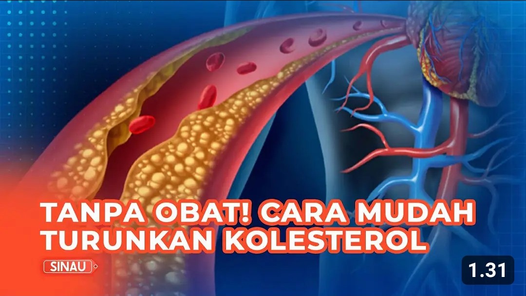 4 Cara Alami Menurunkan Kolesterol Jahat Tinggi dan Gampang untuk Dilalukan