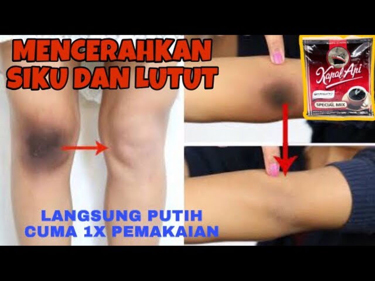 3 Cara Memutihkan Lutut yang Hitam Secara Alami, Kulit jadi Cerah dan Mulus