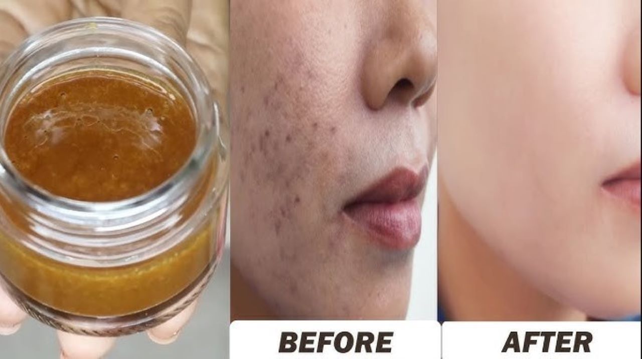 Berikut Cara Membuat Masker Flek Hitam dari Bahan Dapur, Cukup 5 Langkah Saja 