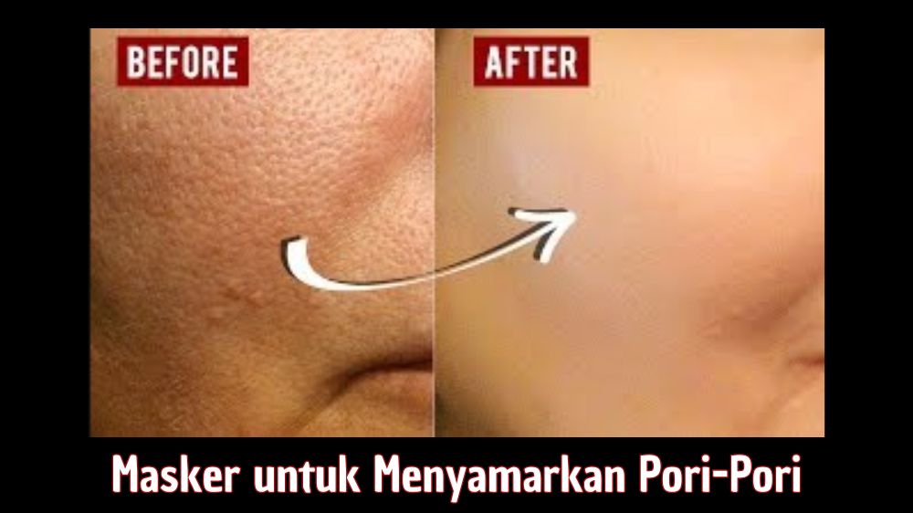 5 Rekomendasi Masker untuk Menyamarkan Pori-Pori, Bikin Wajah Mulus Bantu Atasi Jerawat dan Komedo