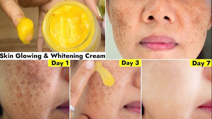 DIY Krim Pemutih Wajah Penghilang Flek Hitam dalam 1 Malam, Bikin Glowing dan Tampak 10 Tahun Lebih Muda