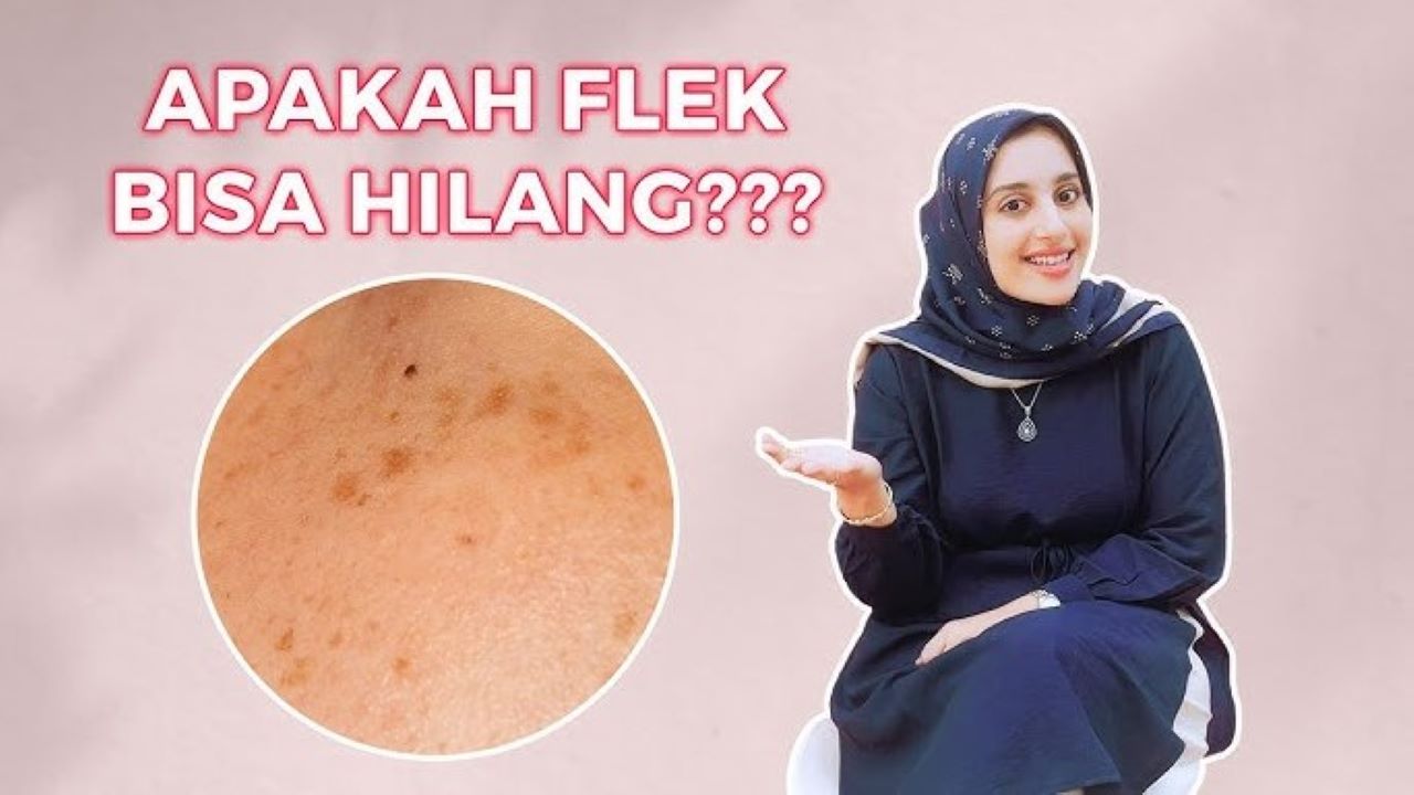 4 Penyebab Noda Hitam Membandel di Wajah, Bikin Kulit Jadi Kusam dan Warnanya Tidak Merata