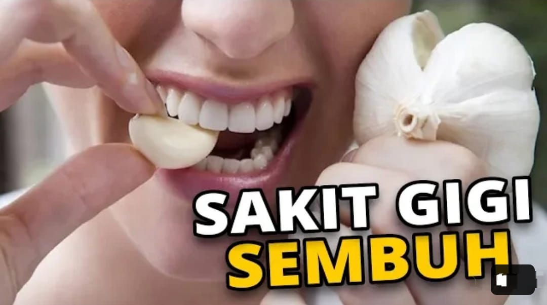 4 Cara Mengatasi Gigi Berlubang Dengan Bahan Alami, Ampuh Redakan Nyeri Dengan Cepat dan Putihkan Gigi Kuning