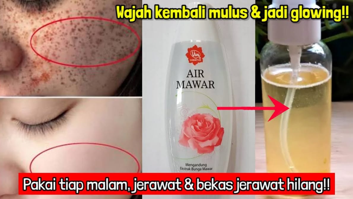 3 Cara Pakai Masker Minyak Zaitun dan Air Mawar untuk Menghilangkan Flek Hitam, Rahasia Wajah Cepat Glowing 