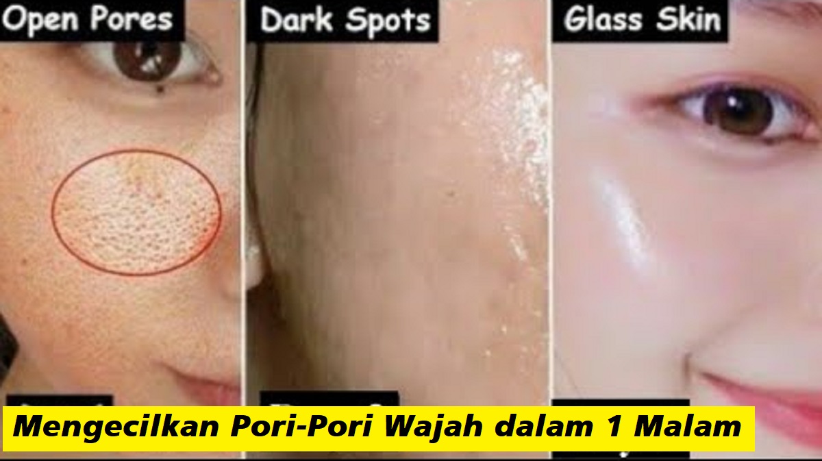 4 Cara Cepat Mengecilkan Pori-Pori Wajah secara Alami dan Permanen dalam 1 Malam, Mulus Glowing Gak Berjerawat