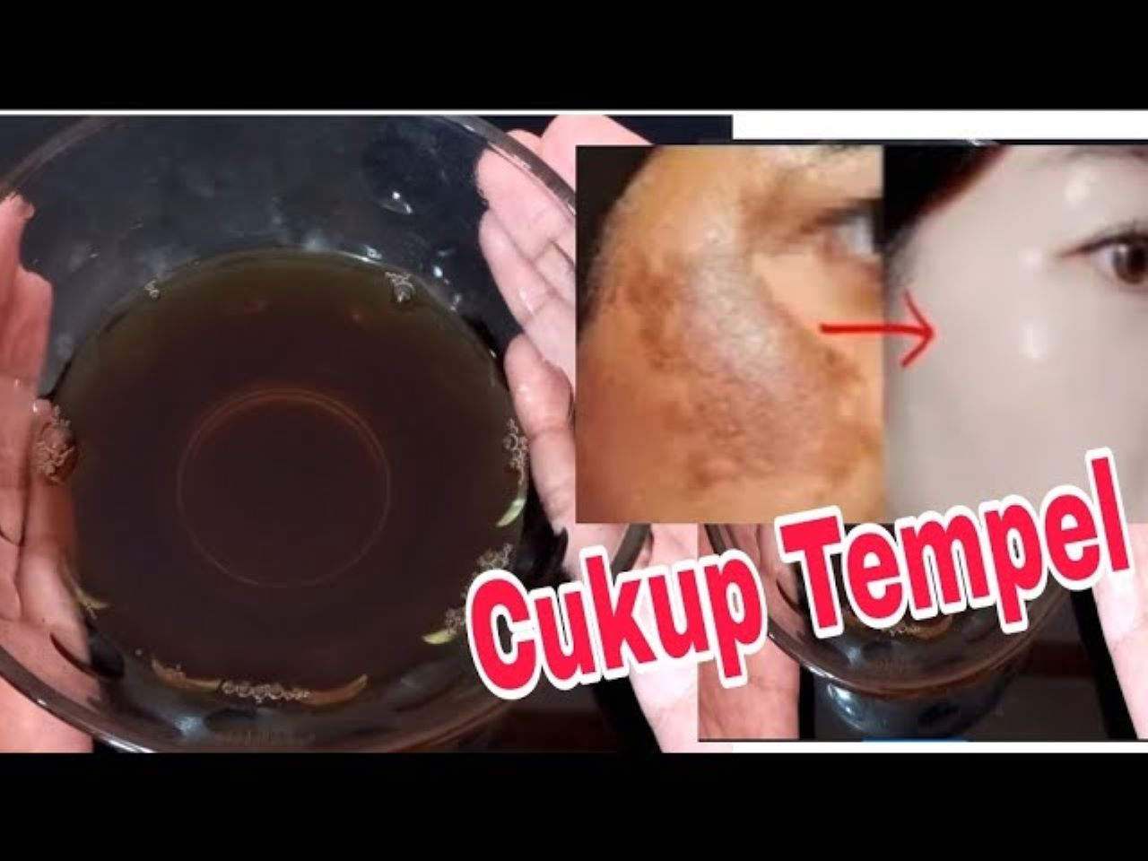 Masker Rempah untuk Menghilangkan Flek Hitam Menahun, Cuma Tambahkan Ini Wajah jadi Glowing dan Putih