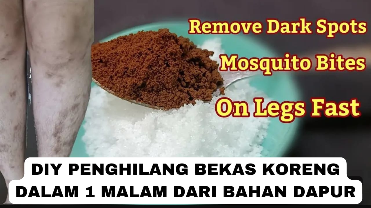 Diy Penghilang Bekas Koreng Hitam Dalam 1 Malam, Kulit Langsung Mulus Glowing Cuma Tambah 1 Bahan Ini