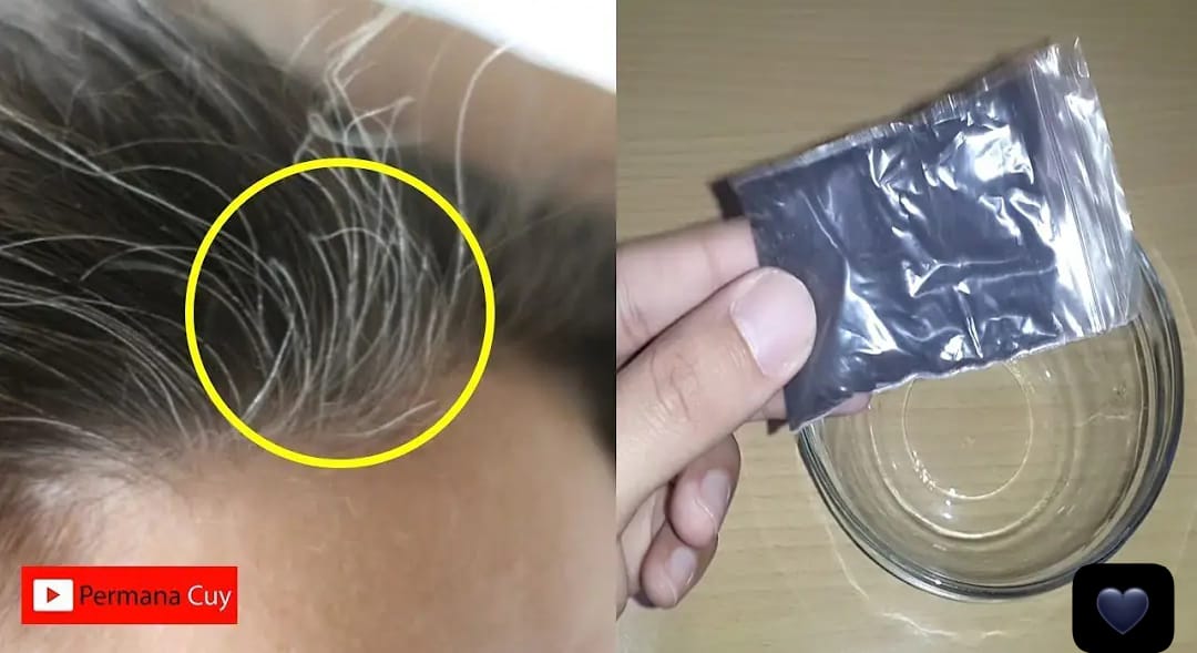 4 Cara Mengatasi Rambut Uban di Usia Muda Secara Alami Agar Hitam Permanen