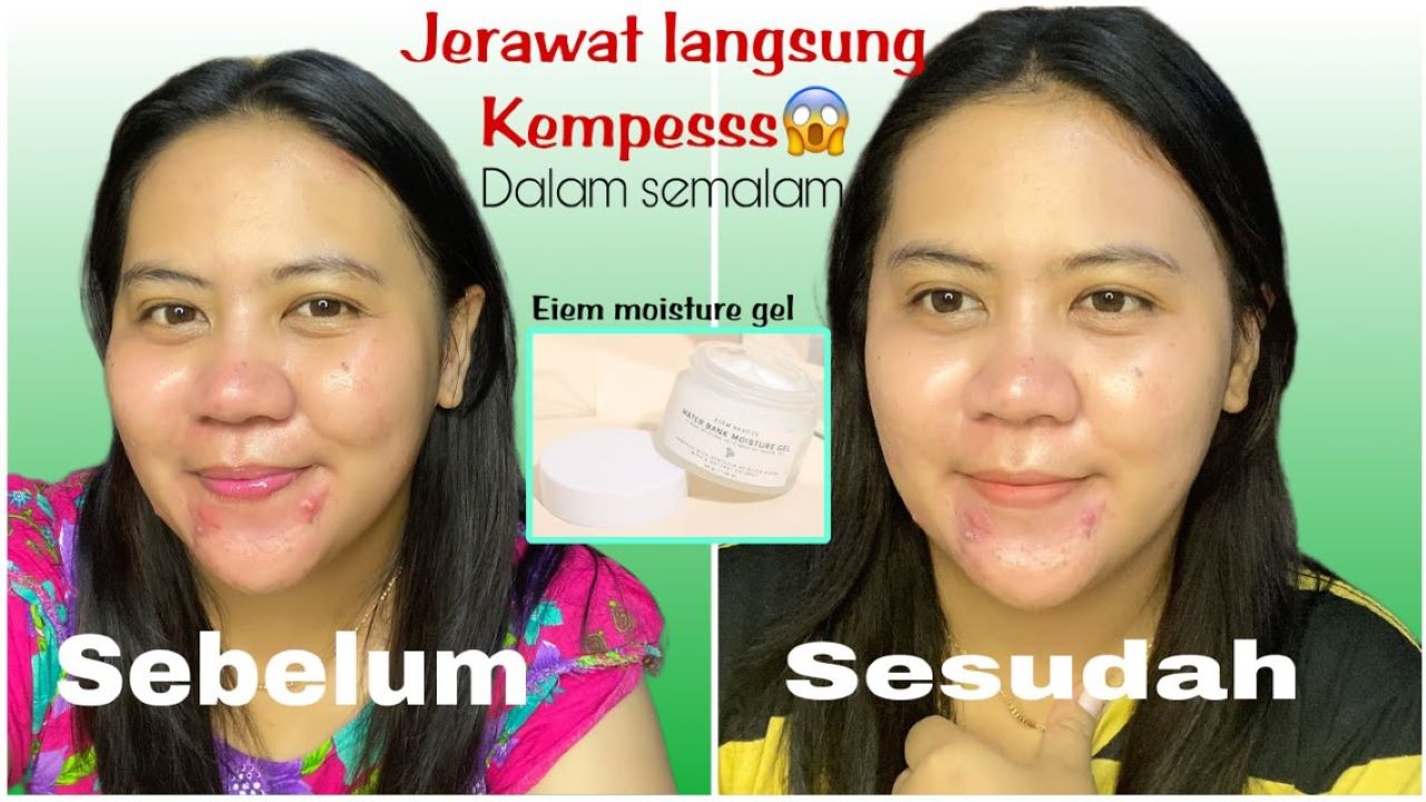 Review Eiem Beauty Water Bank Moisturizer,  Modal 30 Ribuan Bikin Kulit Cerah dan Lembut