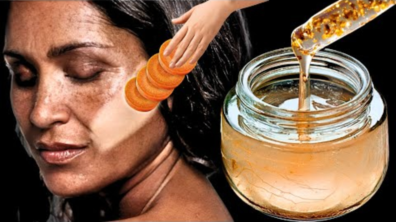 Ini 3 Cara Menghilangkan Flek Hitam yang Menahun di Wajah, Cuma Pakai Bahan Dapur