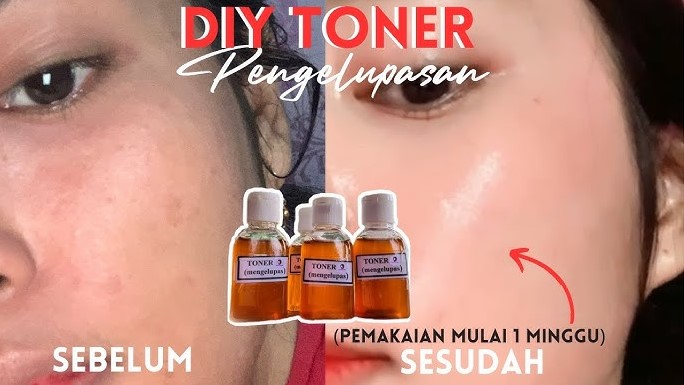 DIY Pemutih Wajah Flek Hitam Racikan Sendiri, Pakai 3 Bahan Alami Langsung Glowing Bebas Noda