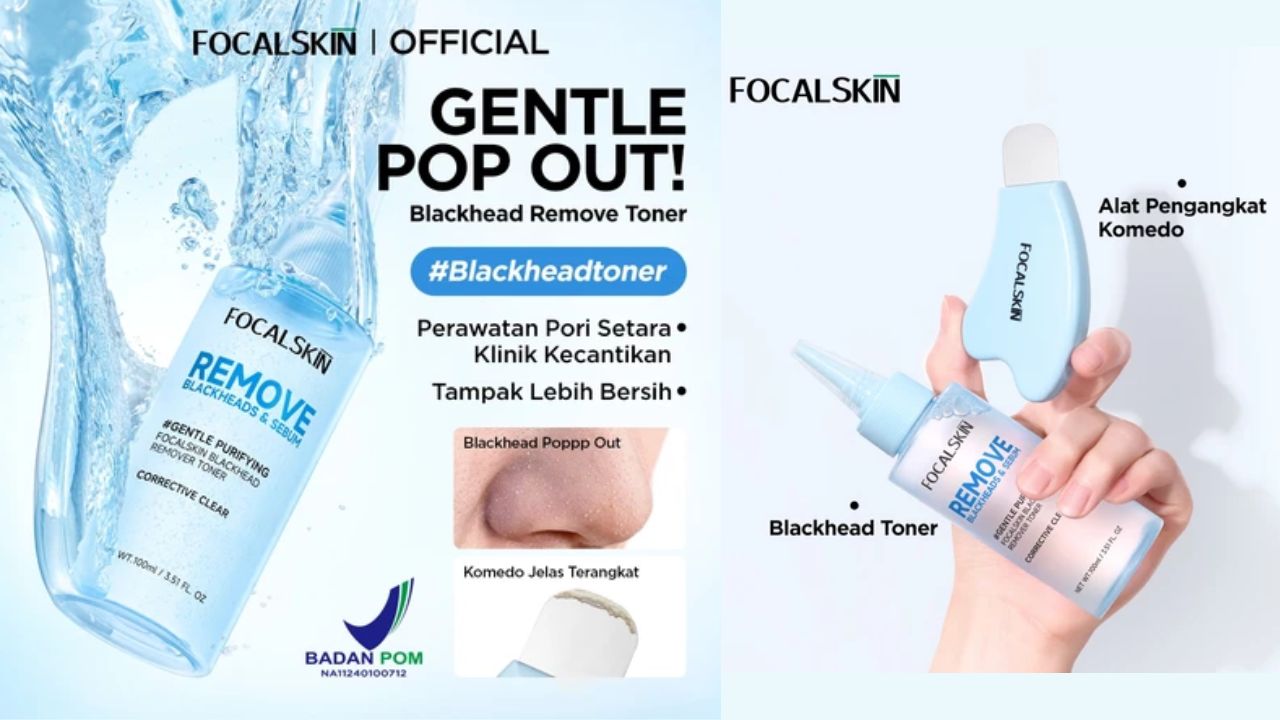NEW LAUNCH! Review Focalskin Blackhead Remove Toner, Wajah Bebas Komedo dalam 10 Menit 