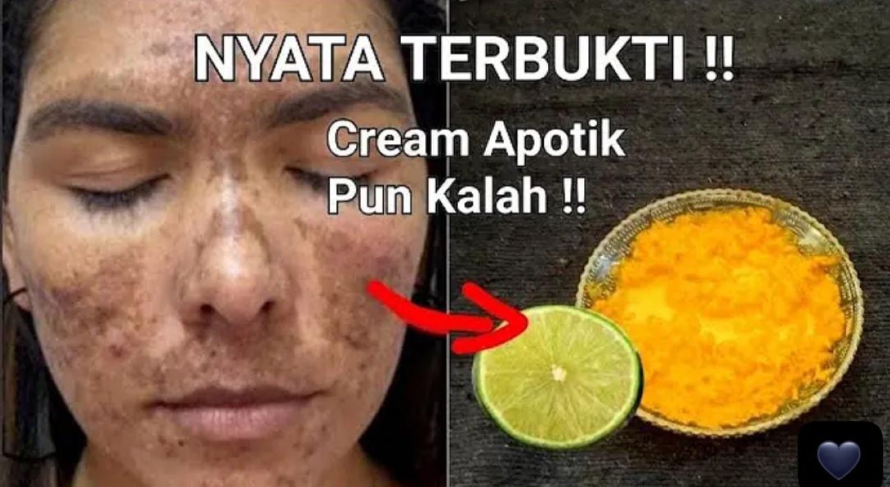 3 Tips Pakai Masker Bubuk Desaku Kunyit untuk Menghilangkan Flek Hitam Membandel