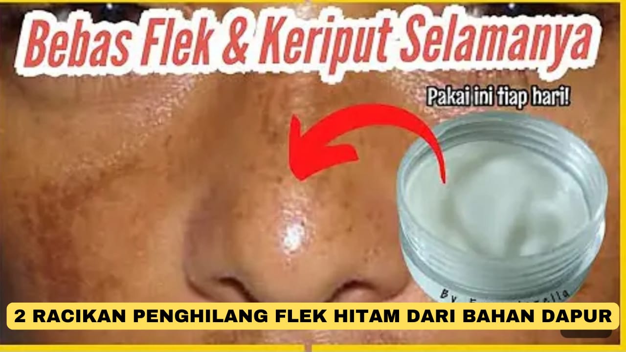 2 Racikan Cream Penghilang Flek Hitam dari Bahan Dapur, Ampuh Pudarkan Noda Hitam Kulit Langsung Glowing!