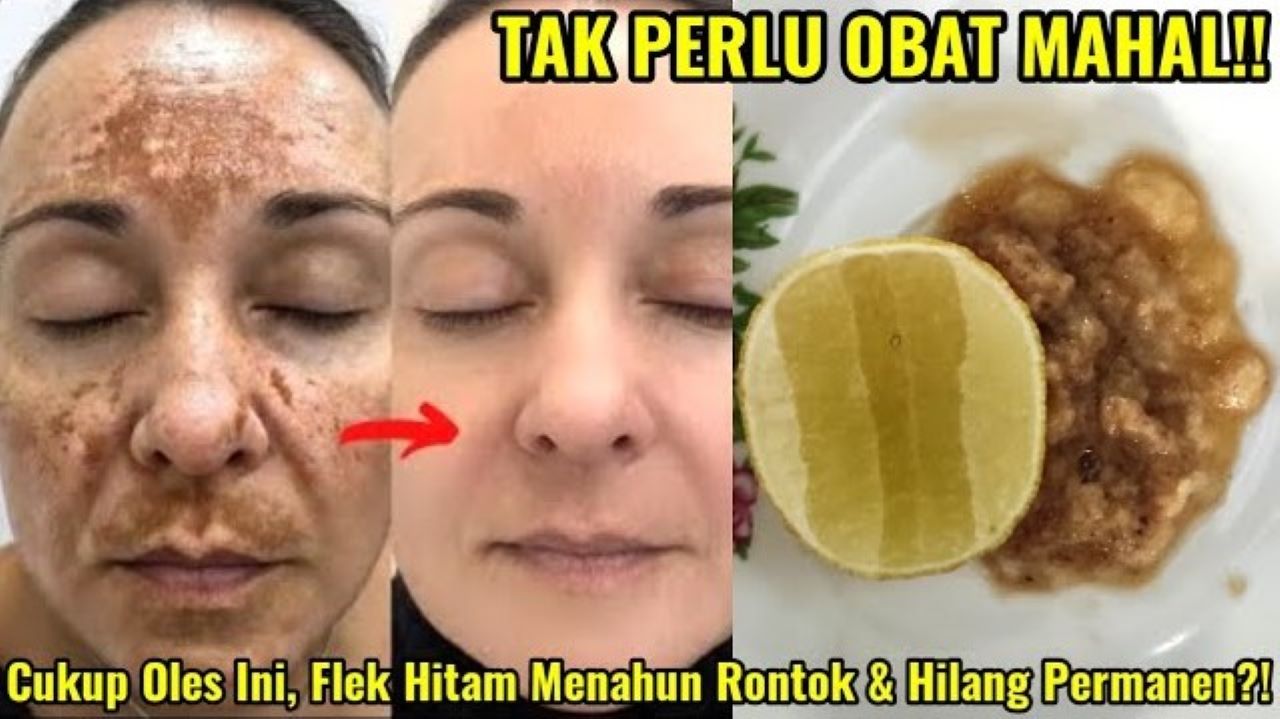 DIY Jeruk Nipis untuk Mengelupas Flek Hitam dalam 1 Malam, Begini Cara Pakainya