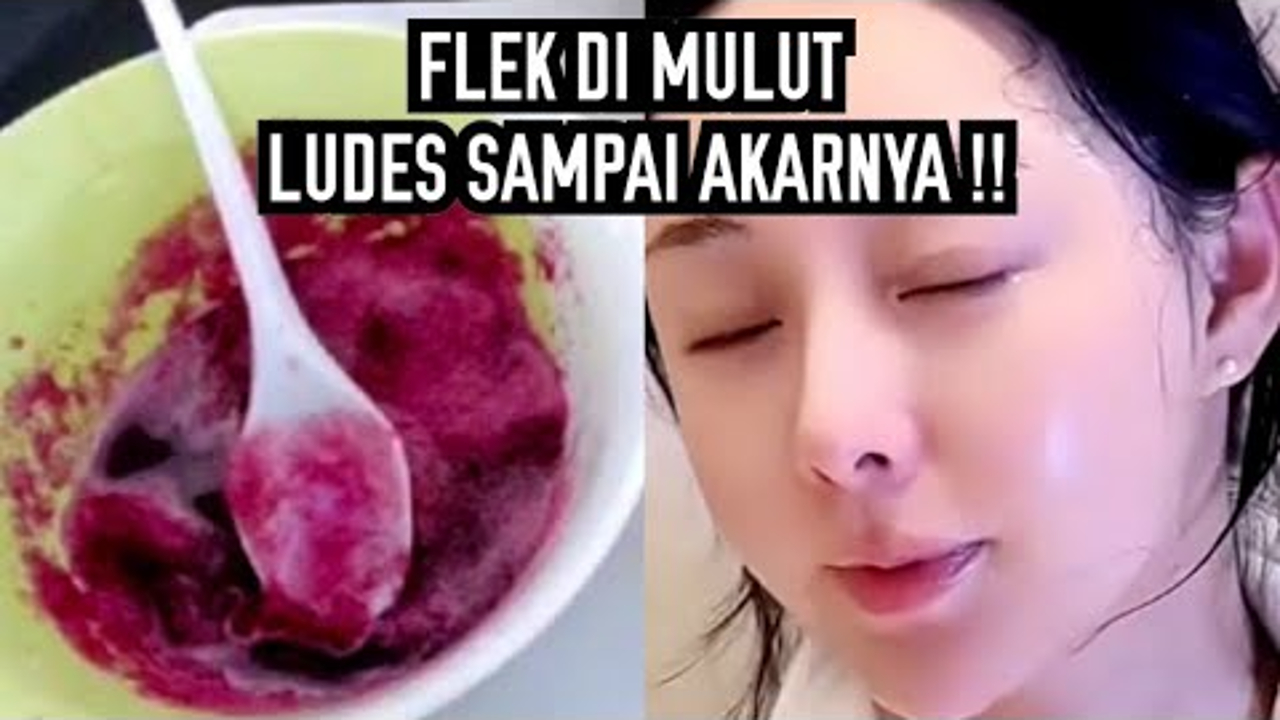 DIY Racikan Pengelupas Flek Hitam Dari Bahan Dapur, Begini 3 Cara Meraciknya