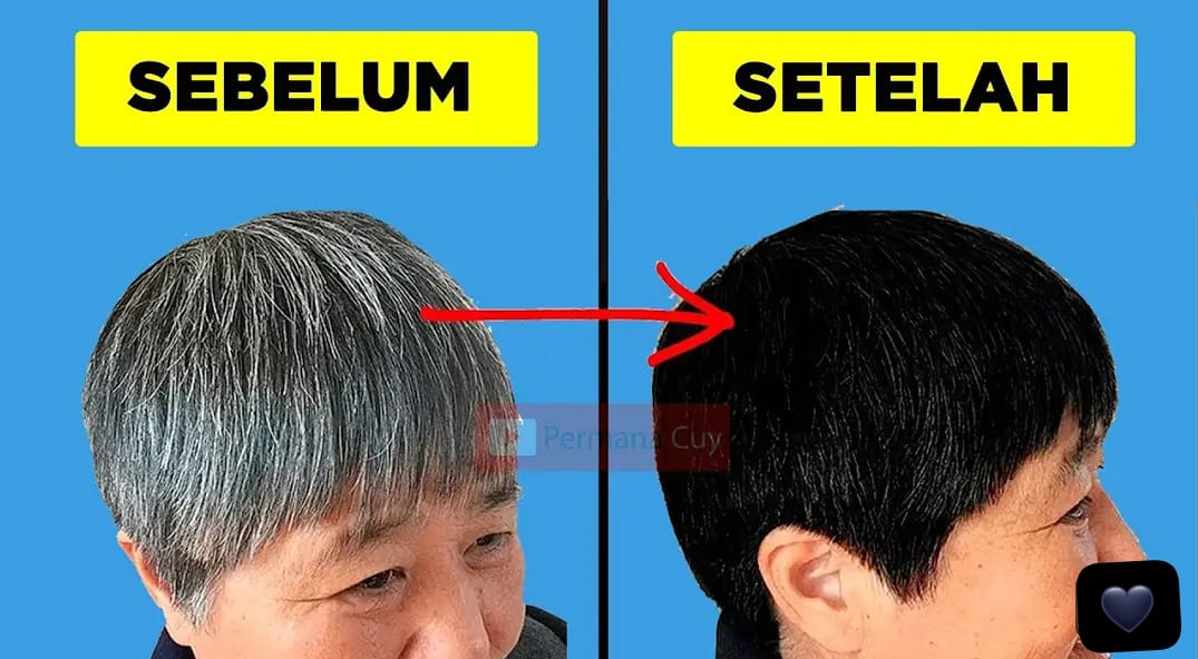 4 Perawatan Menghilangkan Uban Ala Rumahan secara Permanen, Rambut Kembali Hitam Berkilau!