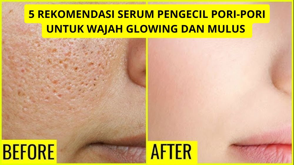 5 Serum Pengecil Pori-Pori untuk Wajah Glowing dan Mulus, Bisa Dipakai Usia 40 Tahun ke Atas Agar Awet Muda