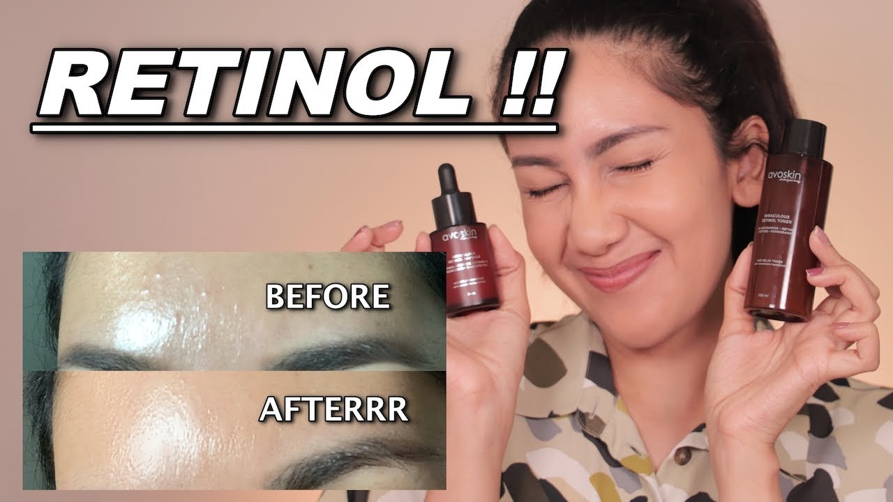 4 Rekomendasi Serum Retinol Brand Lokal yang Bagus untuk Pemula, Ampuh Atasi Penuaan Dini! Tertarik Coba?