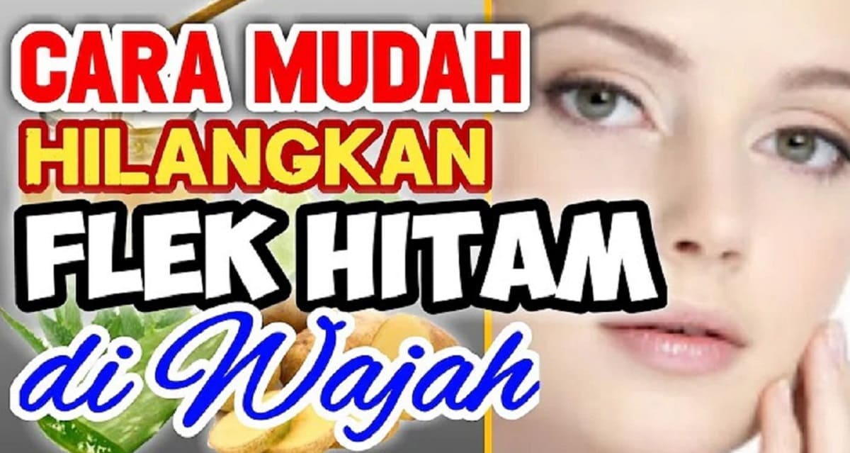 Tips Hilangkan Flek Hitam Menahun Dengan Bahan Dapur Cara Alami Bikin