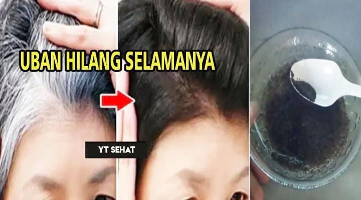 5 Cara Ampuh Hilangkan Uban Secara Cepat dengan Bahan Alami, Efektif dalam Sekali Usap Hitam Sampai ke Akar