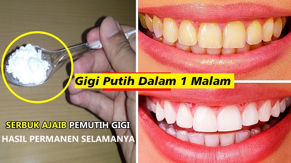 Bahannya Mudah Dicari, Begini Cara Cepat Memutihkan Gigi Secara Alami dalam 1 Hari, Gigi Bersih Bebas Plak 