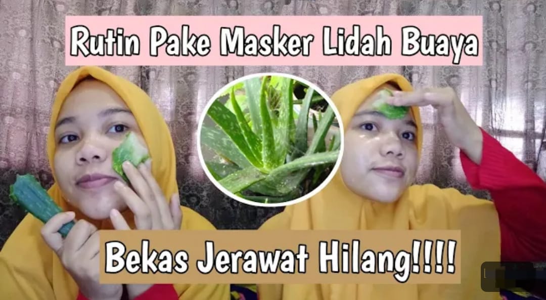 Begini 2 Cara Membuat Masker Lidah Buaya untuk Menghilangkan Flek Hitam Menahun, Bantu Kecilkan Pori-Pori