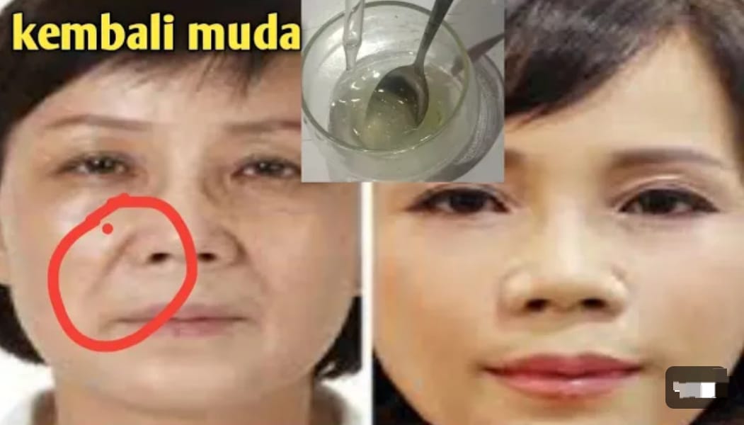 3 Cara Membuat Wajah Awet Muda dengan Lidah Buaya, Wajah Kencang Bebas Noda Hitam dalam 4 Langkah