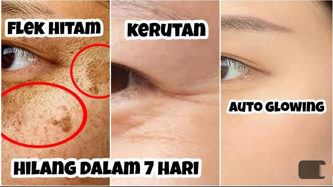 3 Sunscreen Khusus Penghilang Flek Hitam dan Pemutih Wajah, Kulit Langsung Glowing dan Bebas Kerutan di Wajah