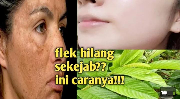 Cara Meracik Daun Penghilang Flek dan Memutihkan Wajah di Usia 50 Tahun ke Atas, Begini Tipsnya yang Benar