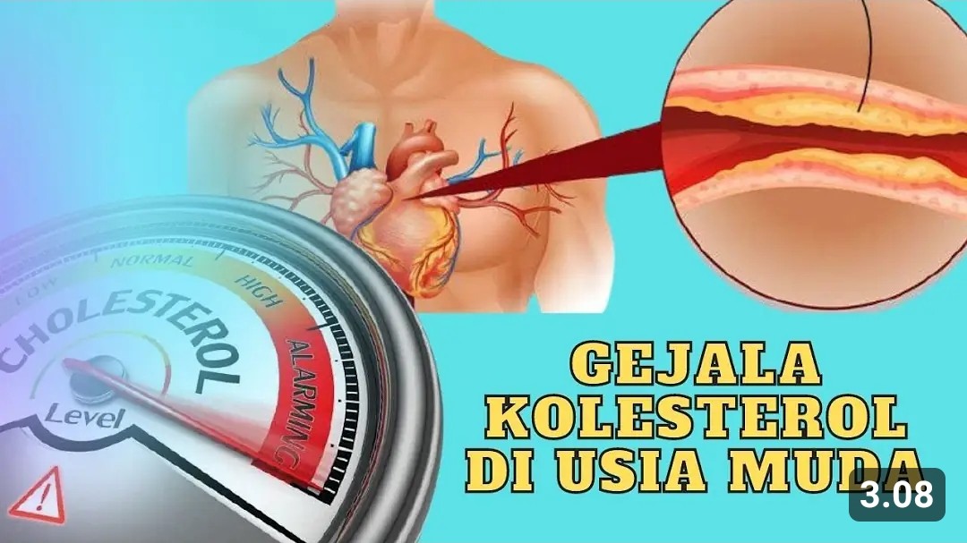 Masih Muda Tapi Kadar Kolesterol Tinggi Sentuh 270, Apa Sebabnya? Ini Kata Dokternya!