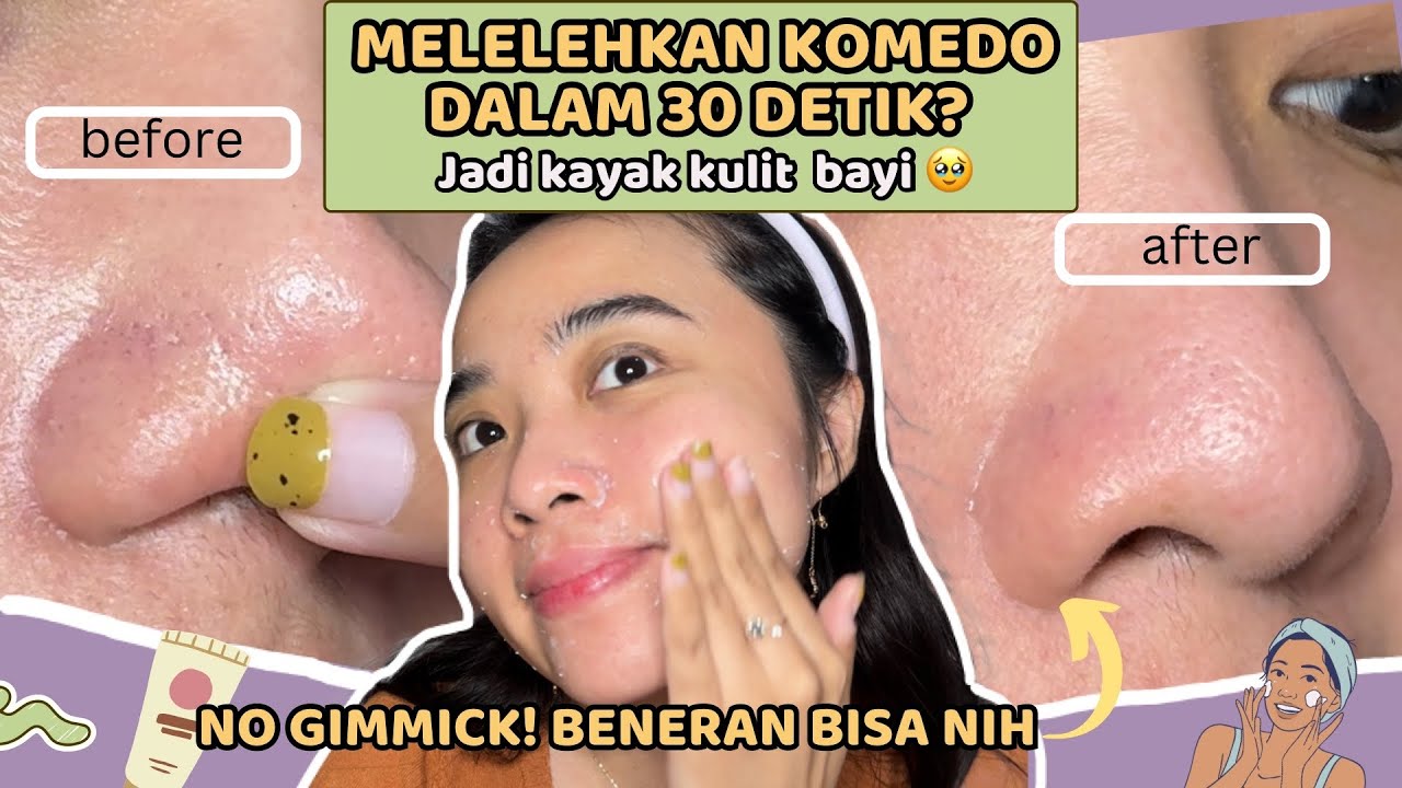 4 Serum untuk Mengecilkan Pori-Pori dan Mencerahkan Wajah, Kulit Terlihat Mulus dan Kencang Bebas Flek Hitam 