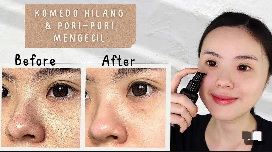 3 Skincare untuk Pori-Pori Besar dan Kusam Terbaik, Wajah Langsung Glowing Bebas Flek Hitam Modal 30 Ribuan