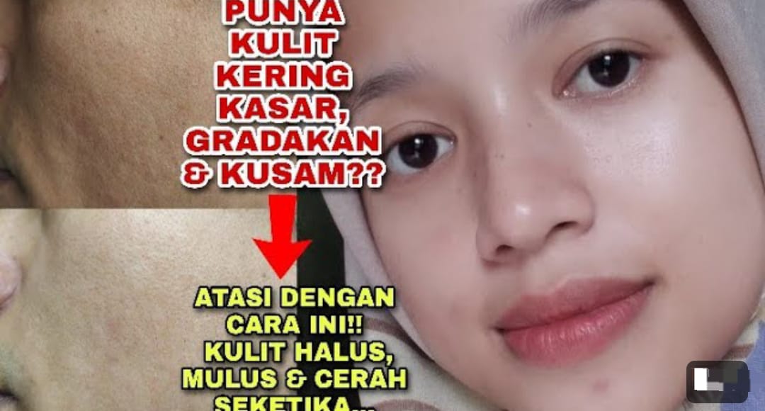 4 Produk Mengecilkan Pori-Pori Wajah Agar Terlihat Mulus Permanen, Kulit Putih Bebas Noda Hitam dan Kerutan