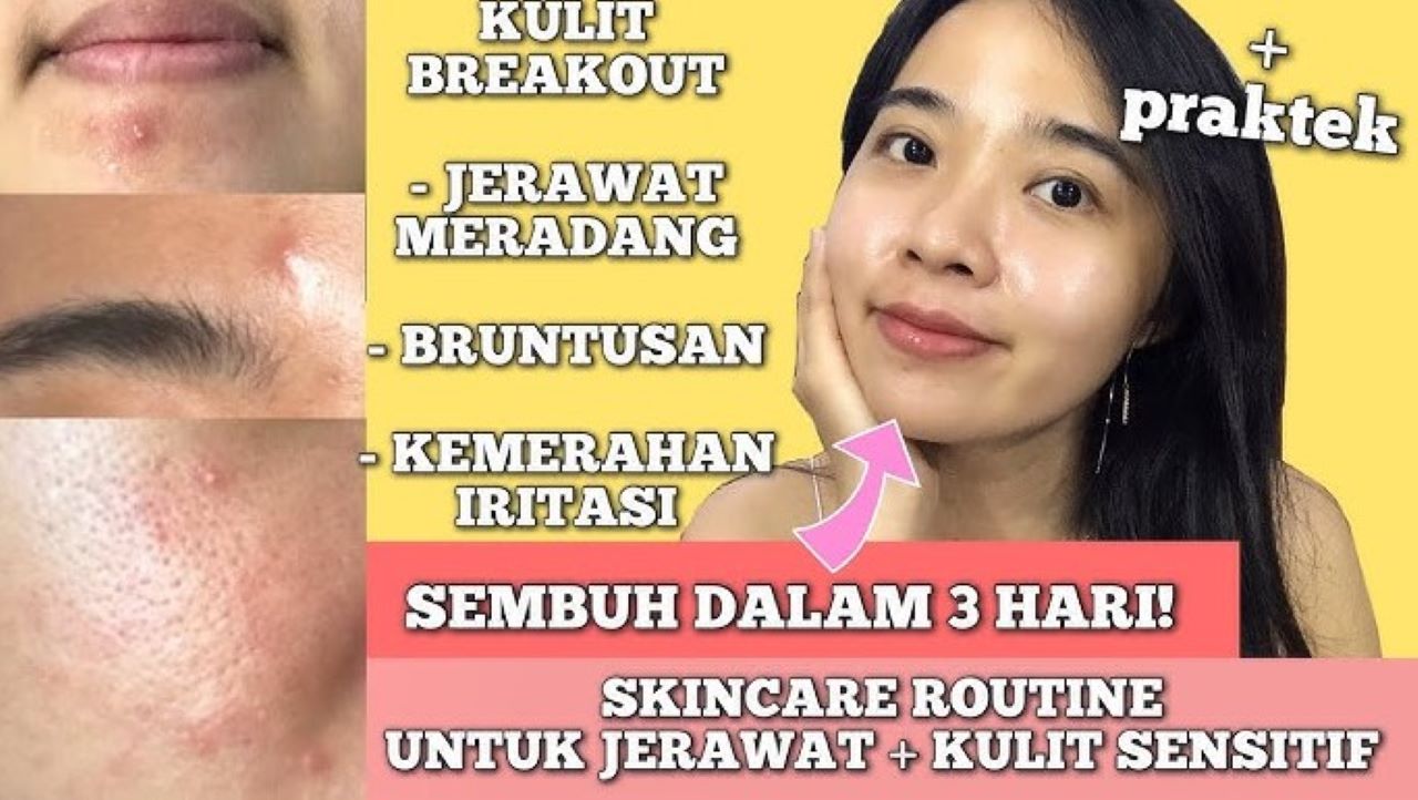 Anti Kemerahan! 4 Produk Skincare untuk Perawatan Kulit Sensitif, Aman dan Sudah Terdaftar BPOM