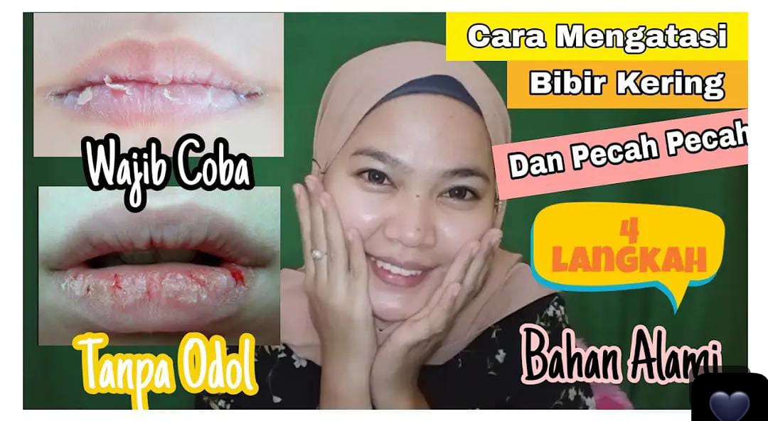 4 Cara Atasi Bibir Kering dan Pecah-Pecah Pakai Bahan Dapur, Langsung Plumpy!