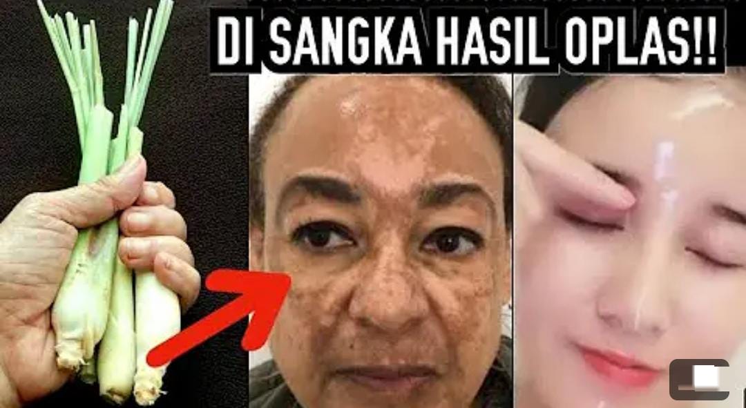 Begini Cara Membuat Air Rebusan Serai untuk Wajah Awet Muda, Kulit jadi Kencang Tanpa Noda Hitam Permanen