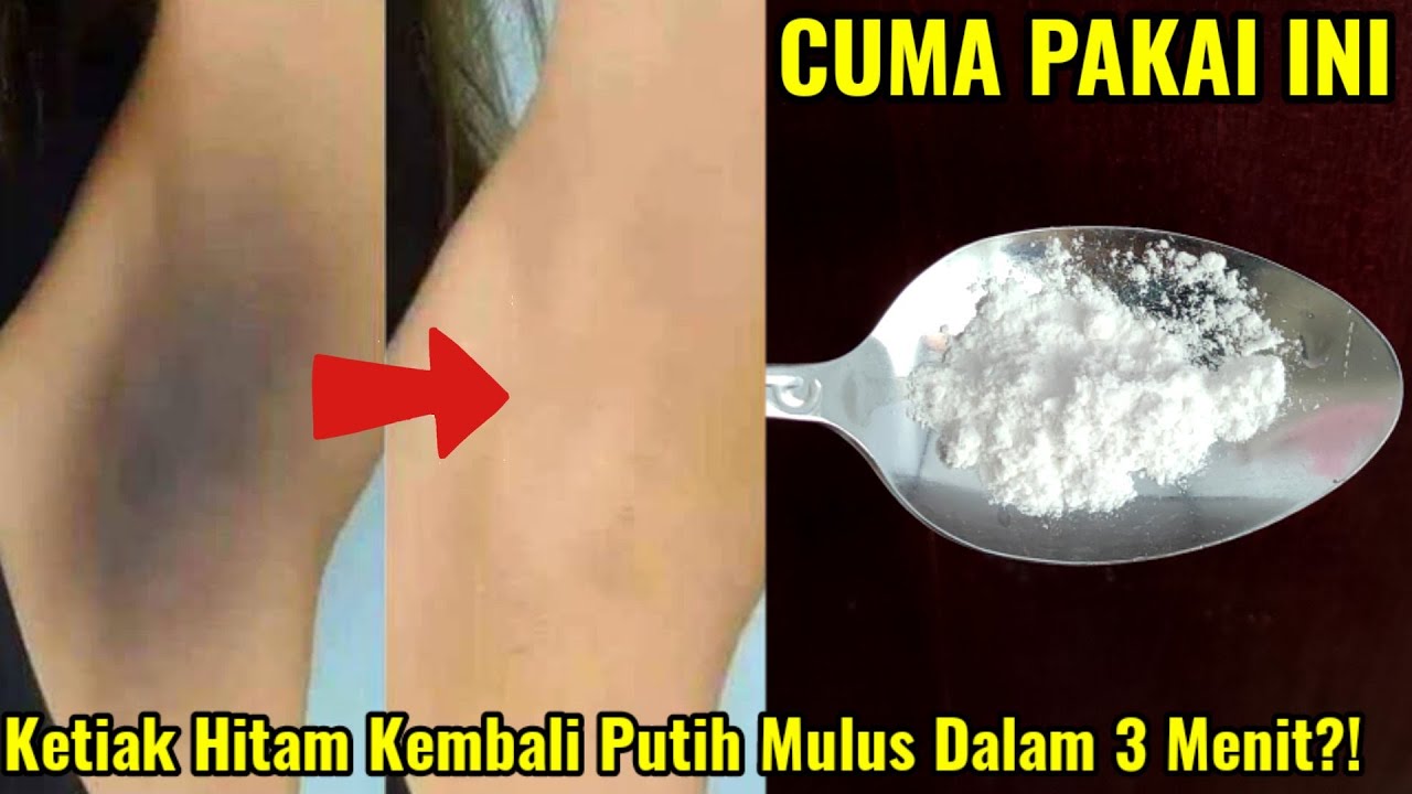 Ini Cara Instan Memutihkan Ketiak Hitam dan Bau, Cuma 1 Bahan Dapur Keringat Hilang Bebas Bau Badan Seharian