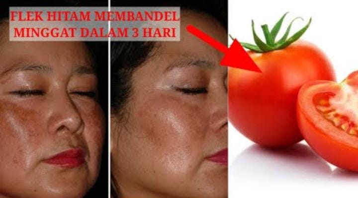Cara Menggunakan Tomat untuk Wajah Usia 50 Tahun Keatas, Bantu Cerahkan Wajah dan Hilangkan Flek