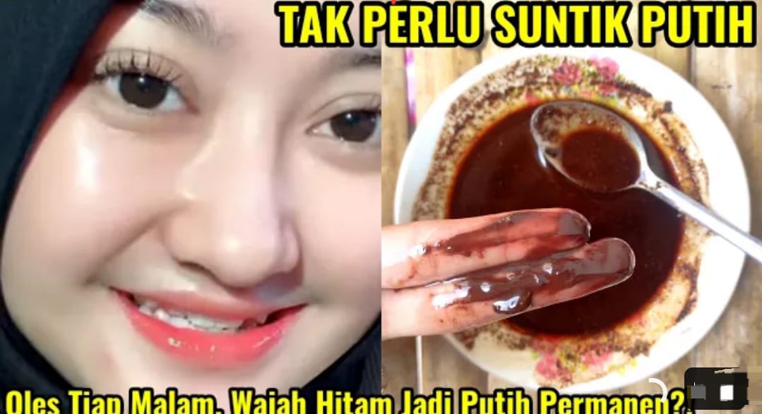 4 Cara Bikin Wajah Glowing dan Putih Dalam 1 Malam, Bantu Atasi Noda Hitam di Wajah Efektif Hilangkan Kerutan