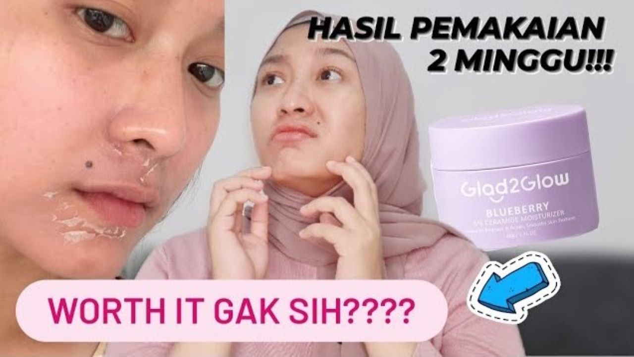 4 Merk Moisturizer Dry Skin yang Bikin Kulit Halus dan Lembut, Nggak Kering atau Bersisik Lagi