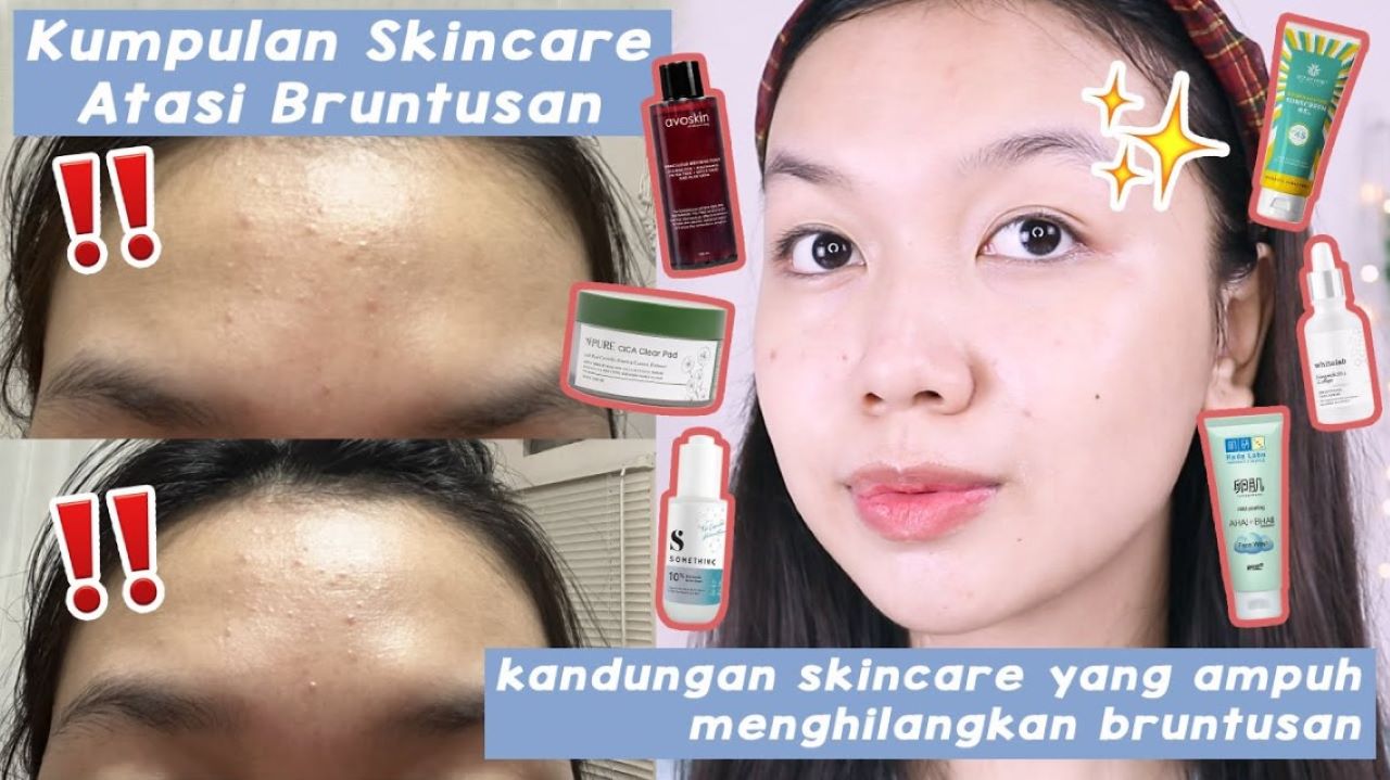 4 Rekomendasi Skincare untuk Bruntusan, Kontrol Minyak dan Bersihkan Pori-Pori 