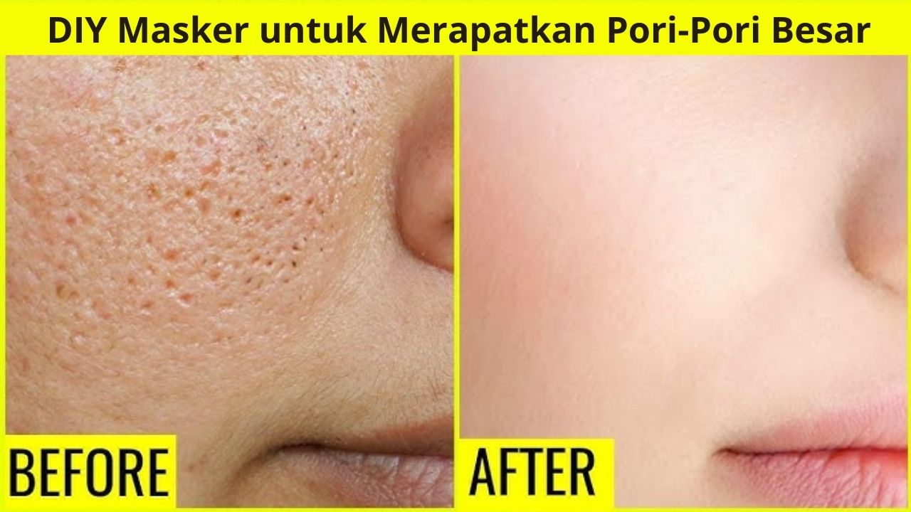 DIY Masker untuk Merapatkan Pori-Pori Besar, Kulit Mulus dalam 5 Langkah 