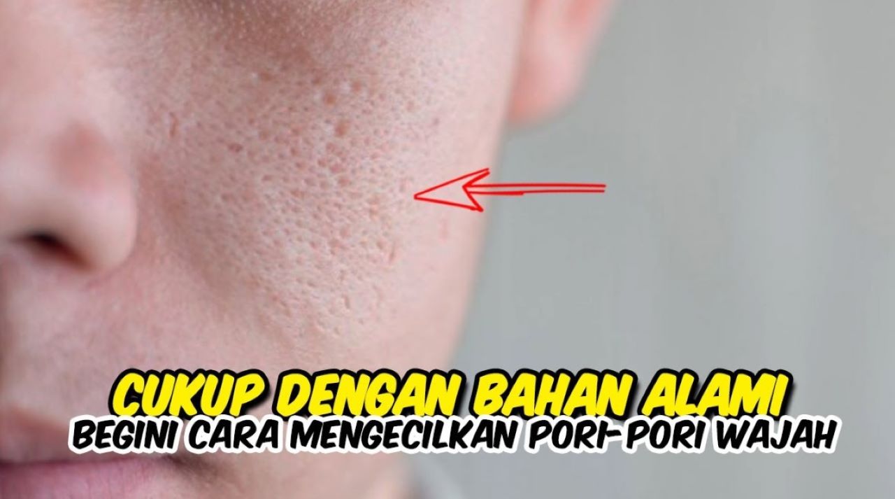 Cara Kecilkan Pori-Pori Pakai Bahan Alami, Hanya Butuh 4 Langkah Saja 