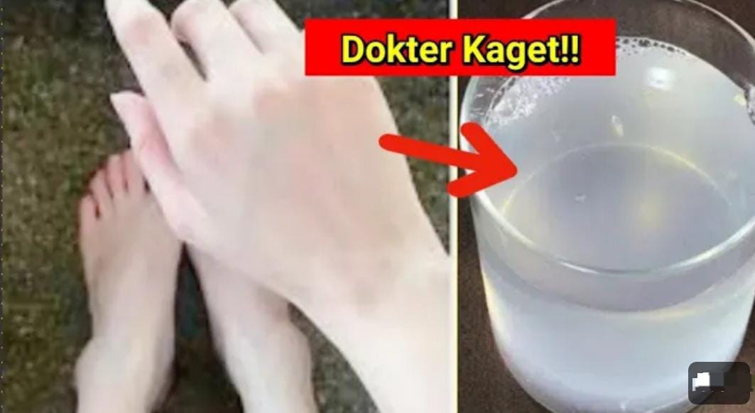 2 Racikan Pemutih Alami Badan dan Penghilang Bekas Koreng Hitam yang Sudah Lama, Kulit Langsung Putih Kenyal