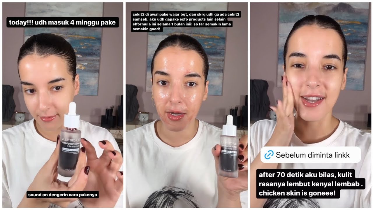 4 Rekomendasi Terbaik Peeling Wajah untuk Mengelupas Flek Hitam! Wajah Auto Glowing