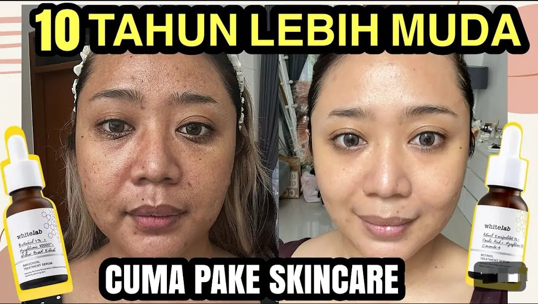 3 Serum Retinol untuk Flek Hitam Wajah Usia 50 Tahun Ke Atas Terbaik, Bonus Bikin Wajah Kencang Awet Muda